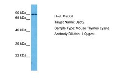 Dact2 Antibody, Novus Biologicals 100 &mu;L; Unconjugated:Antibodies, Polyclonal